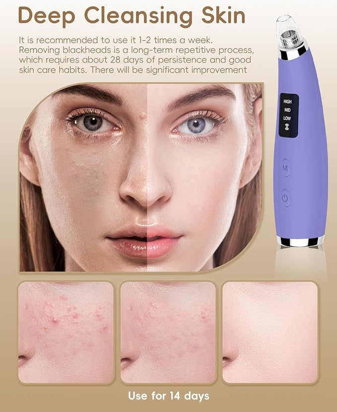 Facial Pore Blackhead Remover Vacuum - Fore Cleaner and Blackhead Extractor with 3 Adjustable Suction Levels - 5 Probes - Pore Vacuum Kit for Women&Men (Matte Purple)