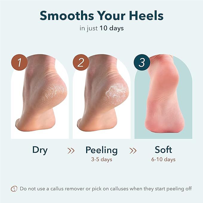 Purederm Exfoliating Heel Mask (1 Pair) – Heel Peeling masks gently remove calluses from your heel