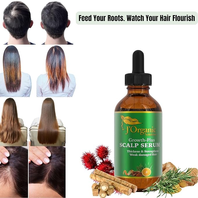 J'Organic Solutions Growth-Plus Scalp Nourishing Oil – Natural Hair Serum for Thicker Edges & Healthy Scalp (2 oz)