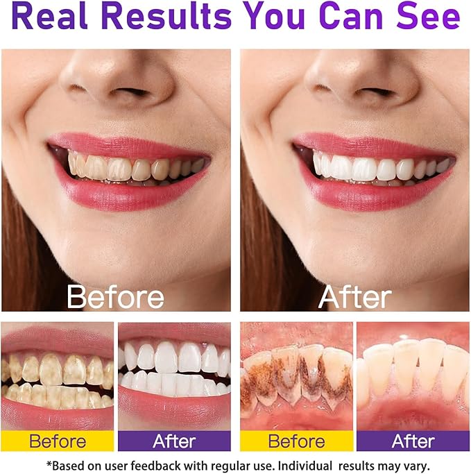 Teeth Whitening Powder - Teeth Whitening - Removes Stains - No Sensitivity - Toothpaste Power - Breath Freshener - for Coffee, Tea and Tobacco Stains 15g