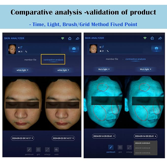 15.6" Professional Skin Analysis Device for Beauty Salons & Spas – AI-Powered 7-Spectral Imaging, 17 Skin Indicators, Multi-Language & Cloud Report Storage
