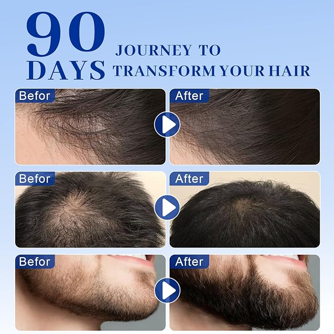 Copper Peptides Hair Growth Serum Women and Men for Thinning Hair Promotes Fullness Reduces Shedding 30ml / 1fl oz