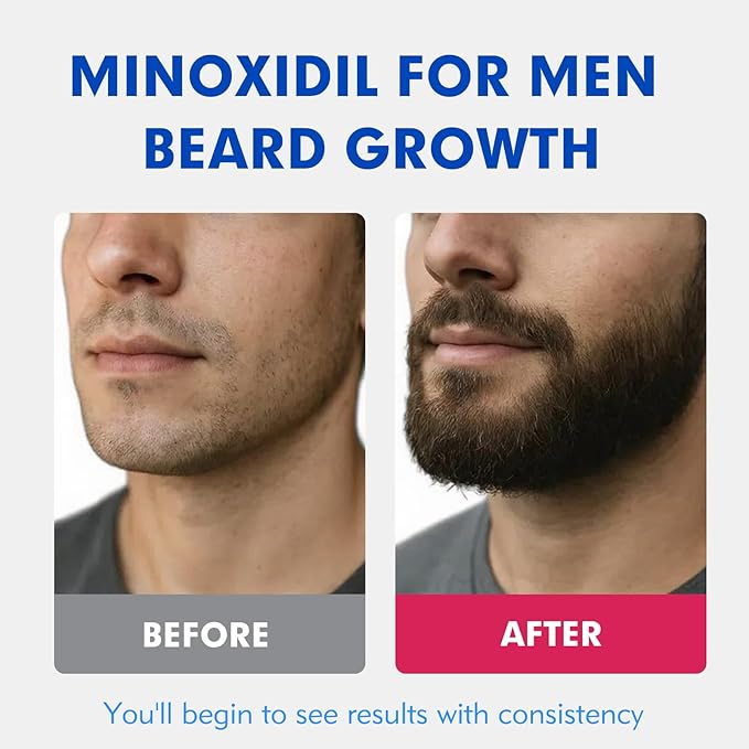 5% Minoxidil for Men Hair Regrowth Treatment, Extra Strength Topical Solution for Thinning Hair & Balding, Beard Growth Enhancer, Non-Greasy Fast-Absorbing Formula, 4-Pack (240ml) 4-Month Supply