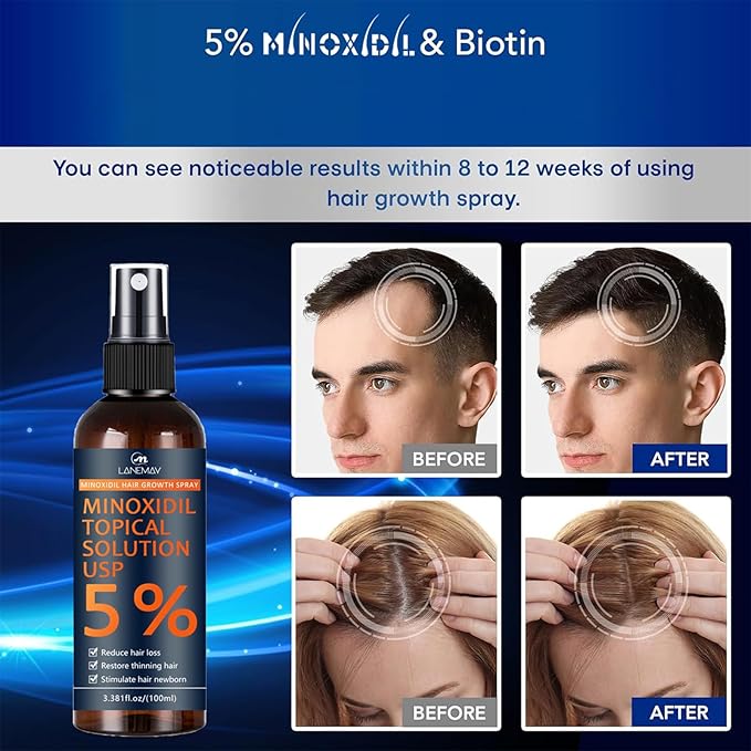 5% Minoxidil for Men Hair with Biotin, Minoxidil for Women, Minoxidil Beard Growth Oil, Minoxidil Hair Growth Serum for Men Hair Growth