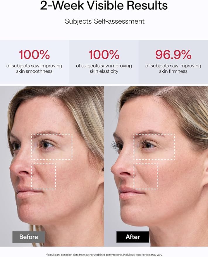 JMOON Microcurrent Facial Device, M30U Red Light Therapy for Face, Safe Anti Aging Skin Care, 4 Modes, 5 Energy Levels for Full Face Lift and Ideal for Smile Lines, Eyes, and Forehead (Red)