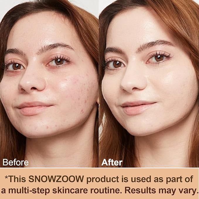 4 in 1 foundation Liquid- Hydrating Medium full coverage concealer -SPF 50+ -Longwearing & Waterproof-korean makeup (Medium Spectrum -Gold Lid- for people with fair skin)