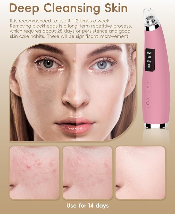 Facial Pore Blackhead Remover Vacuum - Fore Cleaner and Blackhead Extractor with 3 Adjustable Suction Levels - 5 Probes - Pore Vacuum Kit for Women&Men (Matte Pink)