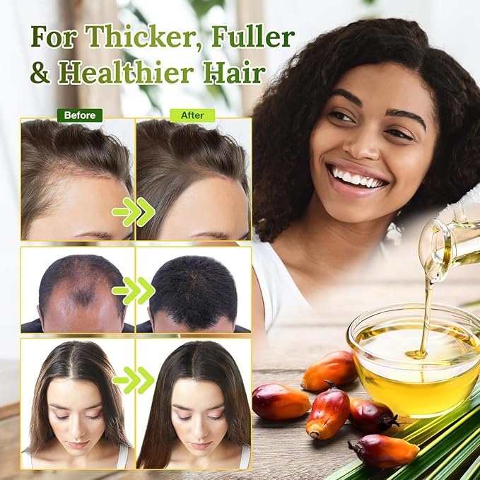 100% Raw Batana Oil for Hair Growth, Natural Raw and Pure Unrefined Batana Oil Organic Hair Oil Prevent Hair Loss, Restores Damaged Hair and Scalp, 4.2 OZ (1 PCS)