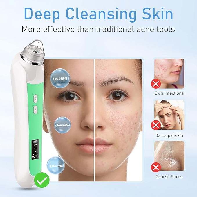 Facial Pore Blackhead Remover Vacuum, 1080P Camera Blackhead Remover, 20x Zoom, 8 LEDs ＆ 3 Suction Modes, 800mAh Battery & USB - 6 Heads Pore Cleaner Kit for Women&Men(Green)