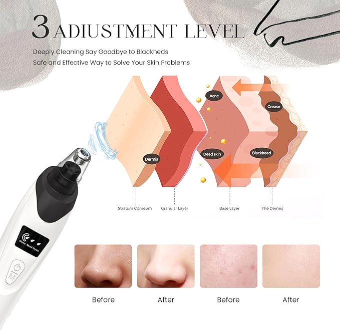 2025 Blackhead Remover Pore Vacuum,Facial Pore Cleaner-5 Suction Power,5 Probes,USB Rechargeable Blackhead Vacuum Kit Electric Acne Extractor Tool for Adult