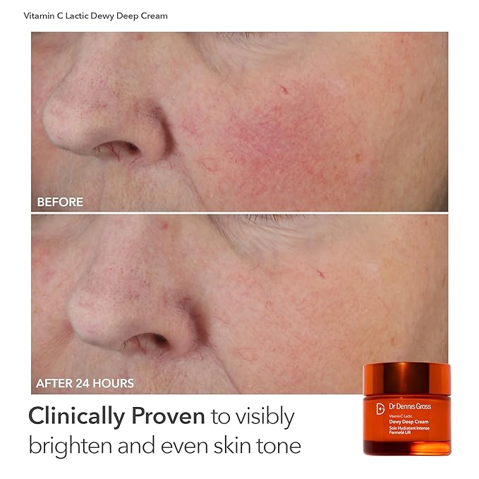 Dr. Dennis Gross Boost Collagen, Brighten & Firm Kit – Pink dpl Faceware Pro LED Device + Cleansing Oil + Dewy Deep Cream + 5 Universal Daily Peels | $592 Value Limited Edition Gift Set