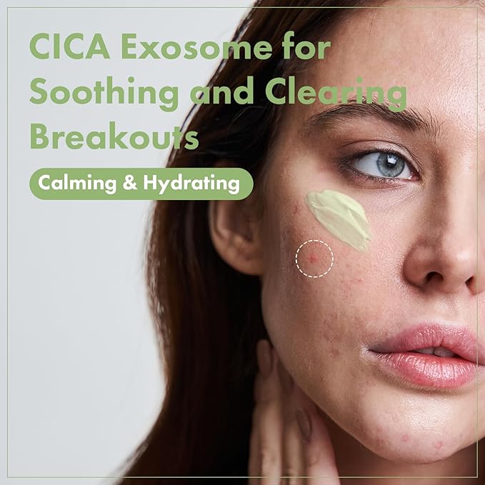 TOSOWOONG Exosome CICA Face Cream - Daily Soothing Moisturizer for Breakouts and Irritated Skin, Fast-Acting, Lightweight Korean Skincare for Redness and Blemish-Prone Skin, 50ml / 1.69 fl. oz.