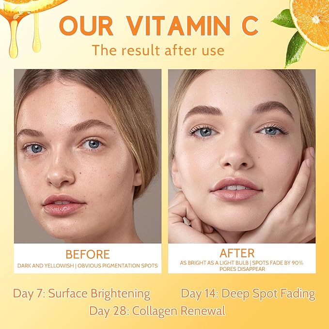 Premium 20% Vitamin C Serum for Face with Vitamin E, Sodium Hyaluronate - Boost Skin Collagen,Hydrate & Plump Skin, Anti Aging & Wrinkle Facial Serum (1 Fl Oz, Scented)