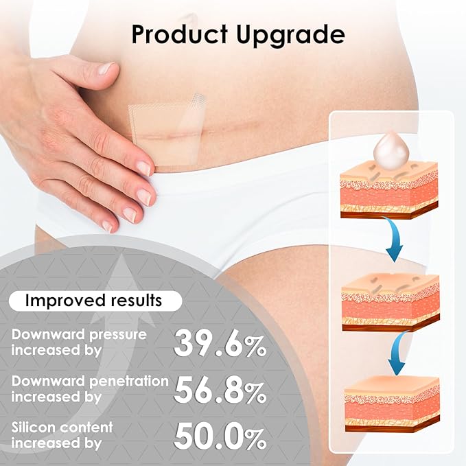 Silicone Scar Sheets,Silicone Scar Tape for Removal Treatment,Medical Grade Scar Tape for Surgical Scars,C-Section,Tummy Tuck,Scar Removal Away(1.6" x 60" Roll - 1.5M) Keloid Bump Removal