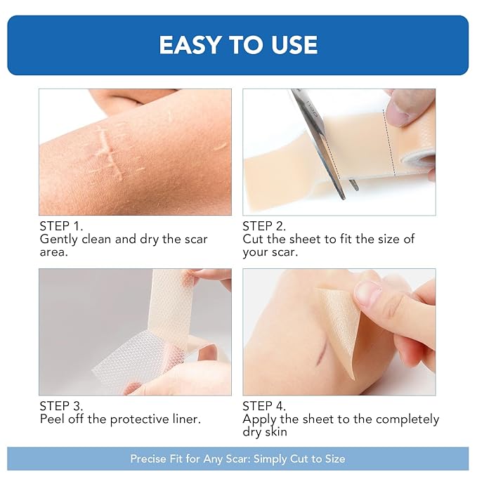 Silicone Scar Sheets, Silicone Scar Tape(1.6"x 200" Roll-5M) - Reusable, Soft & Medical Grade Adhesive Tape for Old & New Scars, C-Section, Surgery, Keloid & Acne Scars
