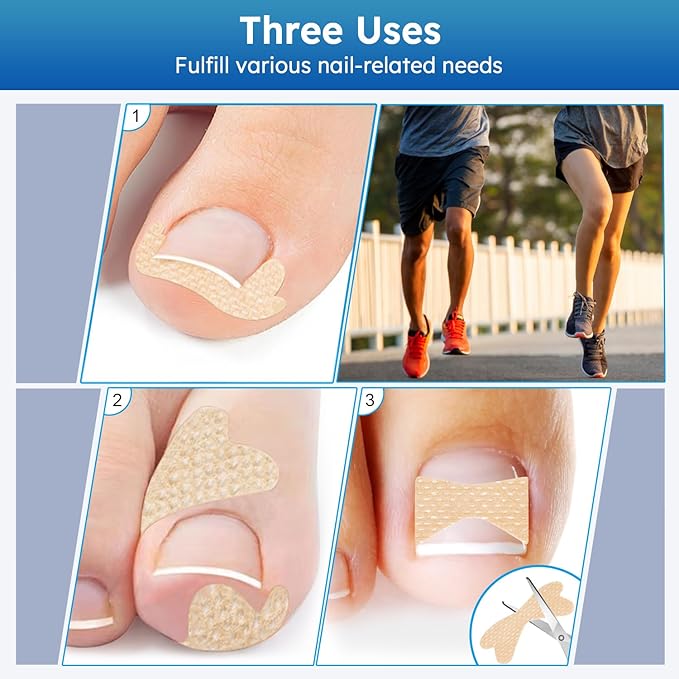Ingrown Toenail Treatment, No Glue Breathable Curved Toenail Corrector，Ingrown Toenail Corrector Strips with File and Lifter, Professional Nail Correction Stickers 60Pcs