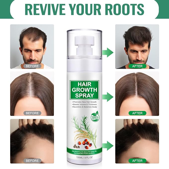 Hair Growth Spray, 2 Pack Natural Hair Growth Oil Spray With Biotin, Batana, Rosemary, and Castor Oil, Caffeine Ginseng Support Scalp Care Treatment, Thinning Hair Regrowth Thickening, Reduce damage