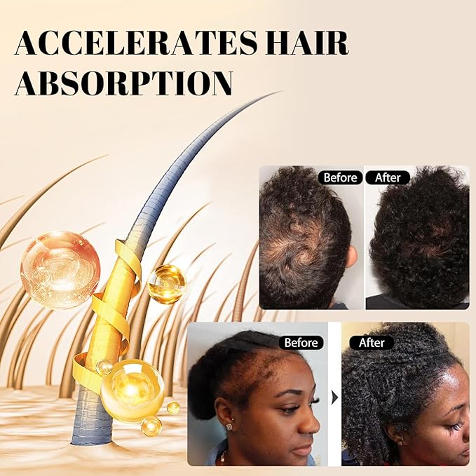Hair Oil, Rosemary Serum with Bamboo Brush for Frizzy, Damaged Hair Growth Strengthening, Scalp and Argan Care for Women and Men