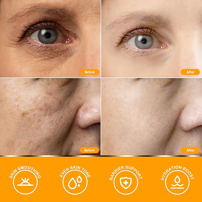 Vitamin C Serum for Women over 70, Vitamin C Serum for Mature Skin Face Hydrates, Firms, Lifts, Targets Age Marks, Wrinkles and Smoothes Skin Texture 1.69 fl oz Pack of 2