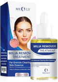 Milia Remover treatment serum, Milia Spot Treatment with Salicylic Acid Milia Acne Serum 25 ML