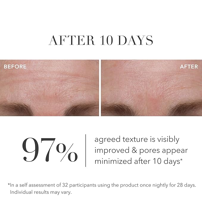 Algenist Green Microalgae Retinol+ Regenerating Serum - Anti Aging Serum with Plant Based, Time-Release Retinol - Evens Texture + Visibly Reduces Deep Lines & Wrinkles with Minimal Irritation (1 oz)
