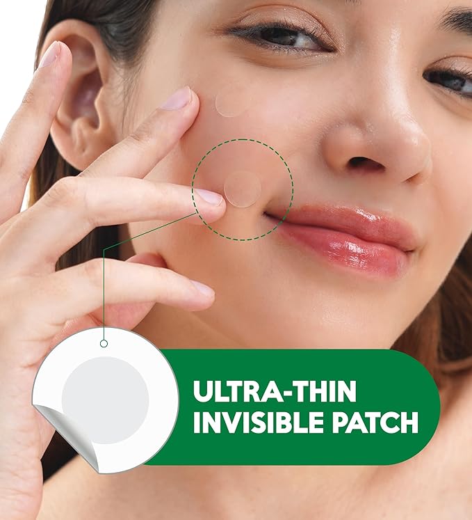 Troubless Invisible Plus Spot Patch EARLY SOS + AFTER CARE Set – Dual Care Hydrocolloid Patches for First Signs and Post-Care – Thin & Comfortable Wear w/ Strong Adhesion (1cm & 1.2cm, 96 ea)