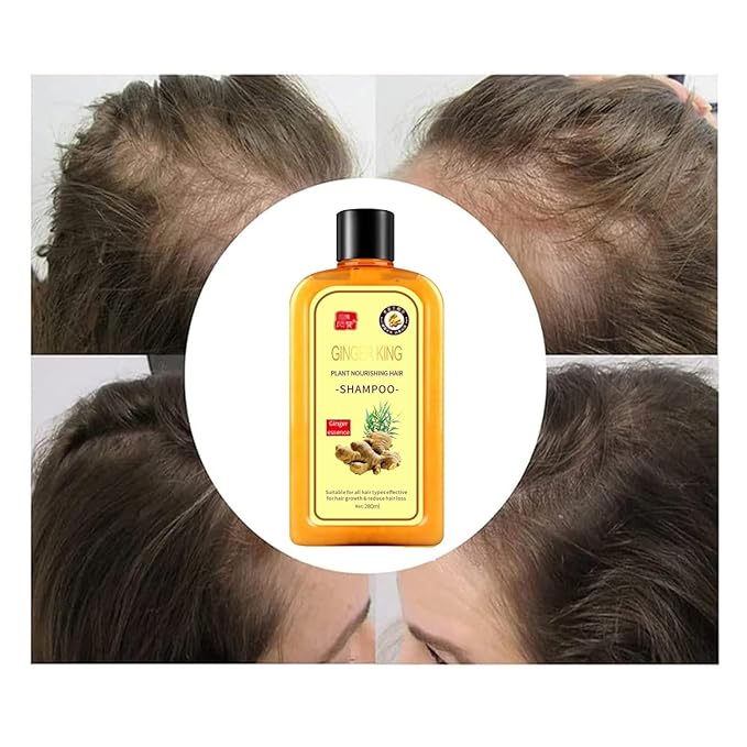 Ginaday Instant Ginger Hair Regrowth Shampoo, Ginger Anti-Fall Shampoo for Hair Growth, Anti-Hair Loss Hair Shampoo (1Pcs 9.47FL.oz/280ML)