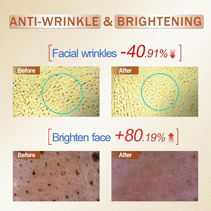 Vitamin C Serum for Face Skin Care Illuminating Serum with Hyaluronic Acid & Collagen, Brightening, Antioxidant, Anti Aging Wrinkles, Glow, Dark Spots Remover Women Hydrating Facial Serums 30ml/1.01oz