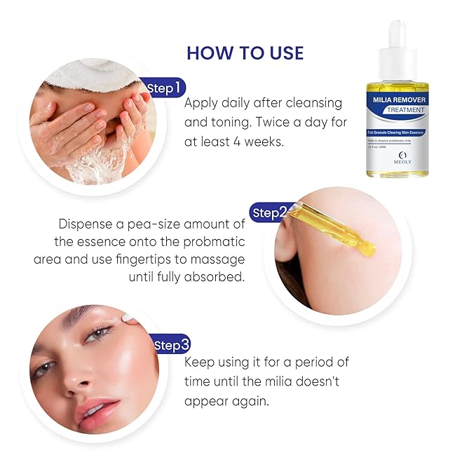 Milia Remover treatment serum, Milia Spot Treatment with Salicylic Acid Milia Acne Serum 25 ML