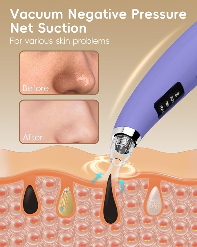 Facial Pore Blackhead Remover Vacuum - Fore Cleaner and Blackhead Extractor with 3 Adjustable Suction Levels - 5 Probes - Pore Vacuum Kit for Women&Men (Matte Purple)