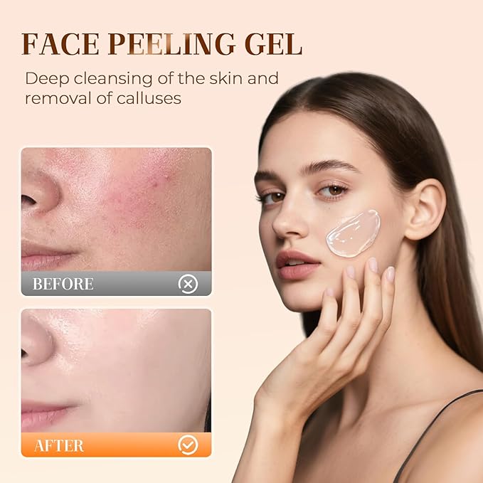Facial Exfoliating Gel, 2025 New Orange Exfoliating Gel Scrub for Face and Body, Orange Peeling Glue Remove Blackheads & Moisturize Skin for All Types Skin (A-2Pcs, One Size)