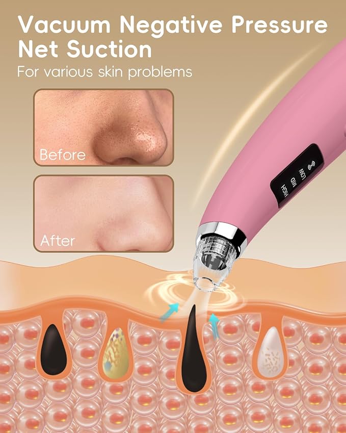 Facial Pore Blackhead Remover Vacuum - Fore Cleaner and Blackhead Extractor with 3 Adjustable Suction Levels - 5 Probes - Pore Vacuum Kit for Women&Men (Matte Pink)