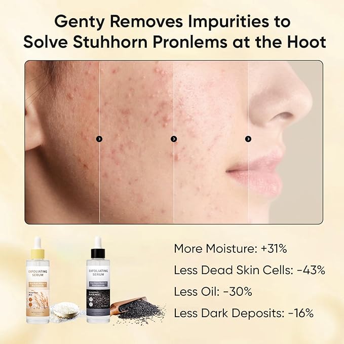Peel Shot Glow Rice Ampoule Duo, Black & White Rice Exfoliating Ampoule for Gentle Peel + Pore Minimizing & Deep Hydration, Suitable for Face and Body (2)