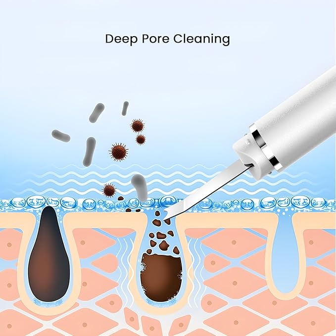 Face Scrubber Skin Spatula, Blackhead Remover Tools, Black Head Remover for Face and Nose, Pore Cleaner for Facial, Deep Cleansing Whitehead Removal Extractor, Skin Care Gifts for Women