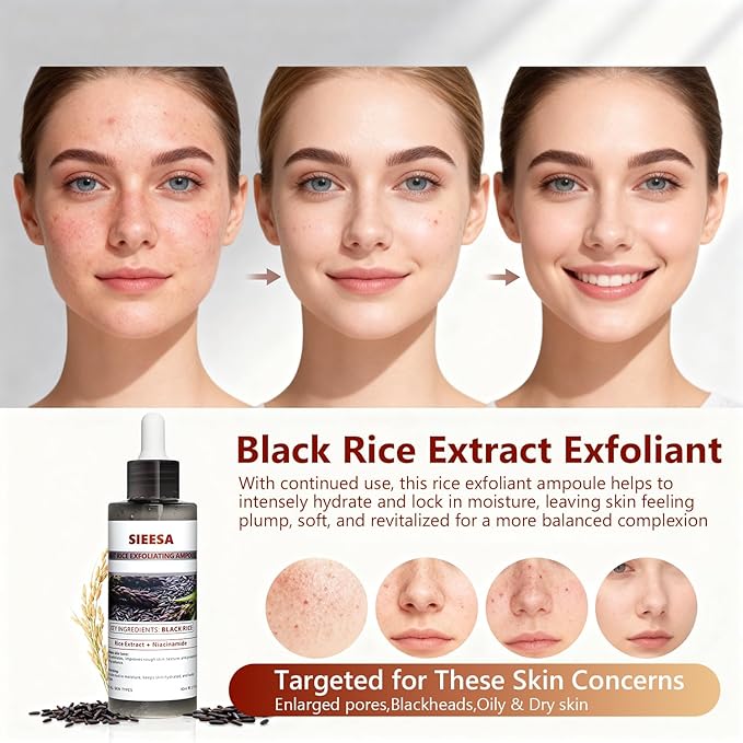 Peel Shot Glow Black Rice Peeling Ampoule, Rice Extract Exfoliating Serum Dead Skin Care for Face and Body Scrub, Gentle Skincare, Pore Refiner & Deep Hydration for All Skin Types（80ML/2.71 Fl Oz）