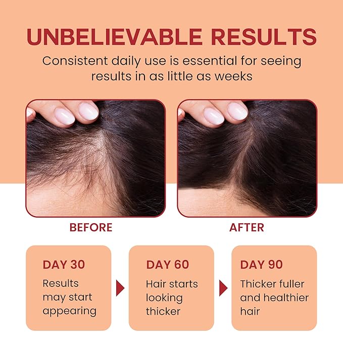 Raw Batana Oil for Hair Growth - 100% Pure, Organic 4oz Batana from Honduras for Thick and Strong Natural Hair - Dr. Sebi Unrefined Cold Pressed Cosmetic Scalp Mask for Men & Women (2 Pack)