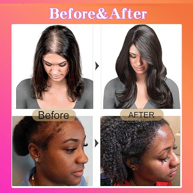 100% Raw Batana Oil for Hair Growth, Natural Raw and Pure Unrefined Batana Oil Organic Hair Oil Prevent Hair Loss, Restores Damaged Hair and Scalp, 4.2 OZ (1 PCS)