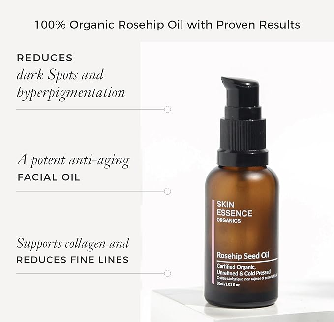Skin Essence Organics Rosehip Seed Oil - Authentic, Cold-Pressed, & Certified Organic (30ml)