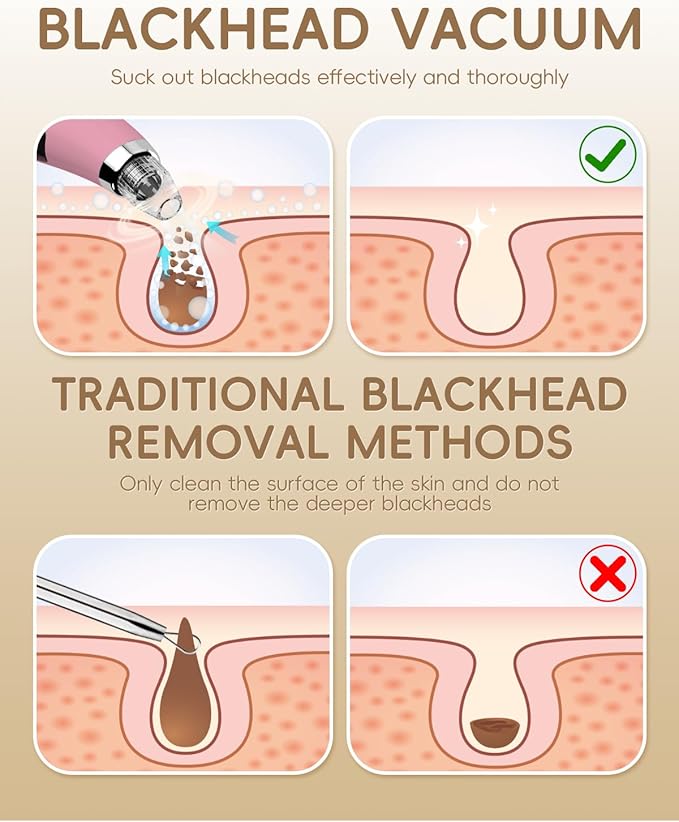 Facial Pore Blackhead Remover Vacuum - Fore Cleaner and Blackhead Extractor with 3 Adjustable Suction Levels - 5 Probes - Pore Vacuum Kit for Women&Men (Matte Pink)