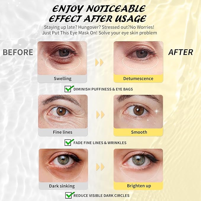 Under Eye Patches(25 Pairs), 24K Gold, Caffeine, Hyaluronic Acid, Aloe Vera Eye Masks for Dark Circles Puffy Eyes Undereye Bags, Eye Skin Care Gift Set for Bachelorette Party Favors