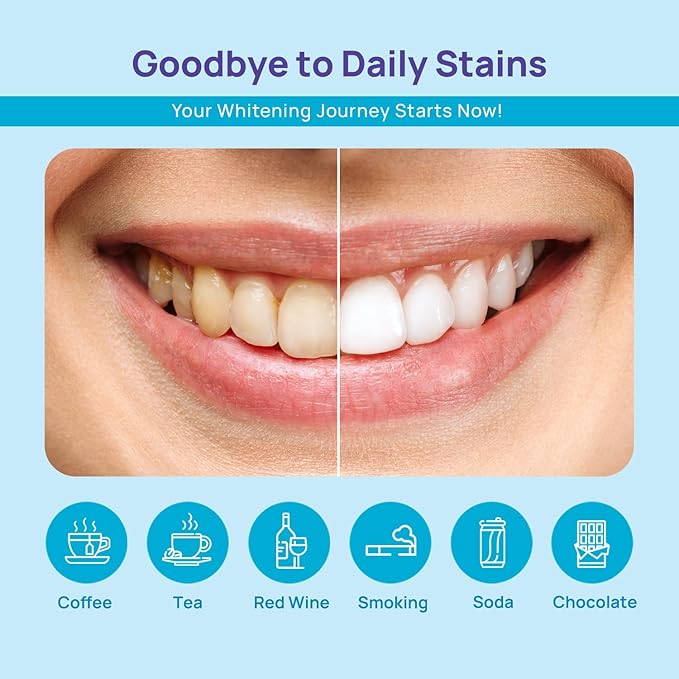 WhiteBite Pro Teeth Whitening Pens for Sensitive Teeth (4 Pens) – 35% Carbamide Peroxide Gel, Desensitizing Gel – Fast Whitening, Enamel-Safe, Travel-Friendly