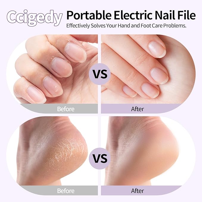 Professional Manicure Pedicure Electric Toenail Grinder Kit - Cordless Electric Nail File Set for Thick Nails Hand Feet Care ,15 Speed,Nail Drill with LED Display Ideal Gift for Men and Women-Purple