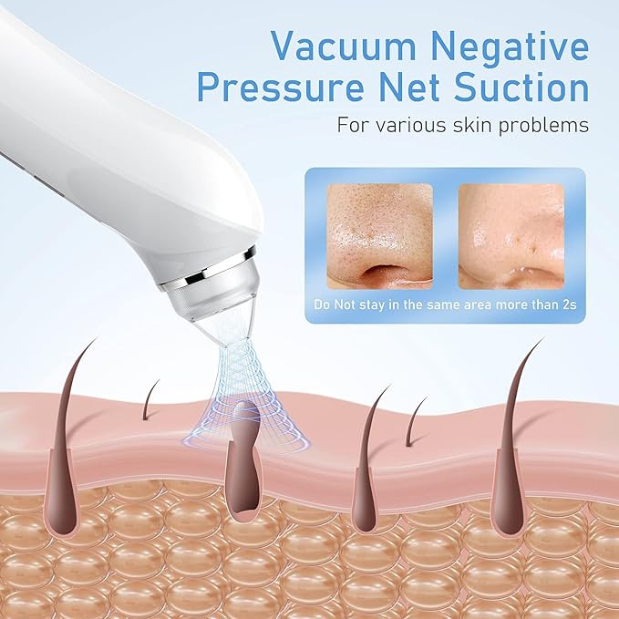Facial Pore Blackhead Remover Vacuum, 1080P Camera Blackhead Remover, 20x Zoom, 8 LEDs ＆ 3 Suction Modes, 800mAh Battery & USB - 6 Heads Pore Cleaner Kit for Women&Men(Black)