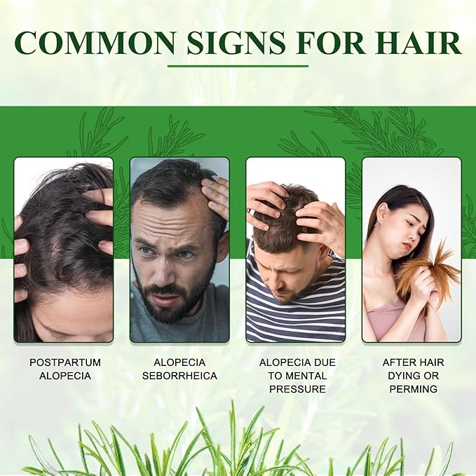 Pure Rosemary Essential Oils, Hair Growth Scalp Oil for Dry Damaged Hair(2.02 Fl Oz)