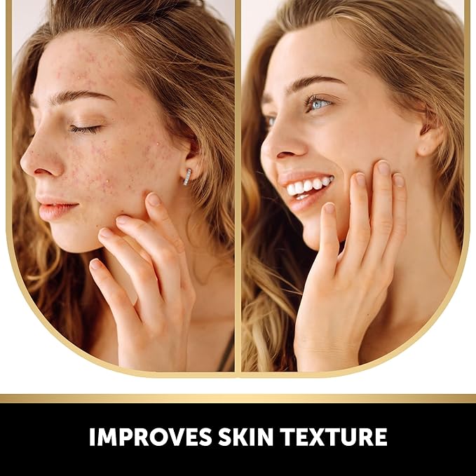 VALITIC Kojic Acid Soap for Hyperpigmentation - with Glutathione, Collagen & Vitamin C - Natural Soap Bars with Turmeric - Original Japanese Complex for Dark Spot Correction - 2 Pack + Holder