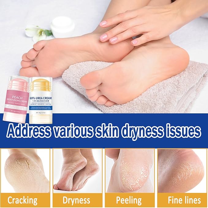 2PCS 60% Urea Cream plus 2% Salicylic Acid Foot Cream, Hydrating and Anti-Cracking Foot Cream, Maximum Strength Urea Foot cream Exfoliates Dead SkinRepairs and Hydrates Dry and Cracked Feet and Hand