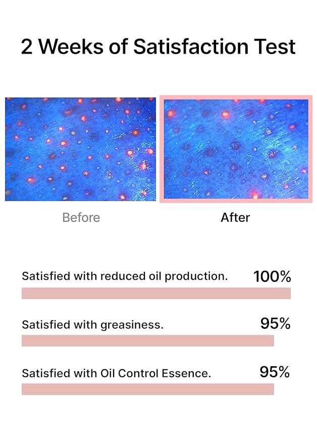 celimax Oil Control Capsule Essence | with Tea Tree Extract, For Sebum Reducing Serum, Mattifying, Hydrating, Moisturizing Mild Formula for Sensitive, 30ml