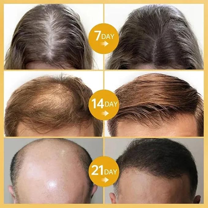 LOVILDS Rosemary Hair Growth Essence, Lovilds Rosemary Hair Growth Oil - 2 Ounce, Rosemary Rosemary Hair & Hair Strengthening Oil for All Hair Types (1 Bottle)