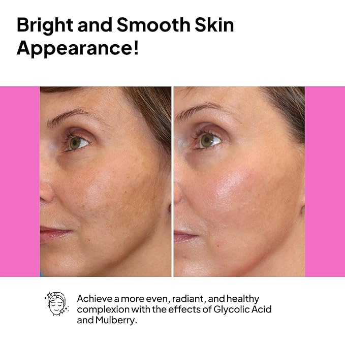 pH Lab Light Up Anti-Spot Serum, Even Skin Tone, Clean Pores, Help Prevent Blemish Formation, 1.01 Fl Oz (Pack of 1)