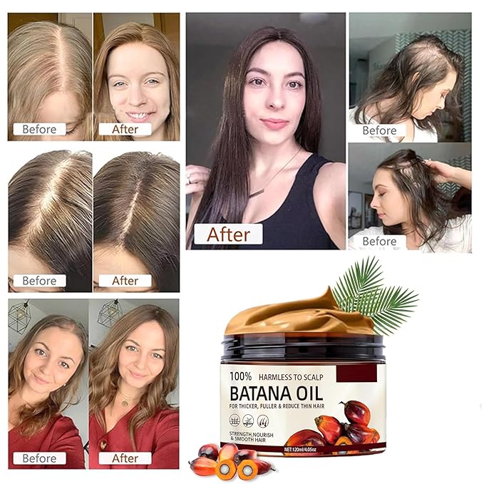 100% Raw Batana Oil for Hair Growth, Natural Raw and Pure Unrefined Batana Oil Organic Hair Oil Prevent Hair Loss, Restores Damaged Hair and Scalp, 4.2 OZ (1 PCS)